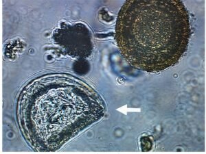 tapeworm