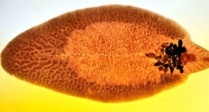 liver fluke